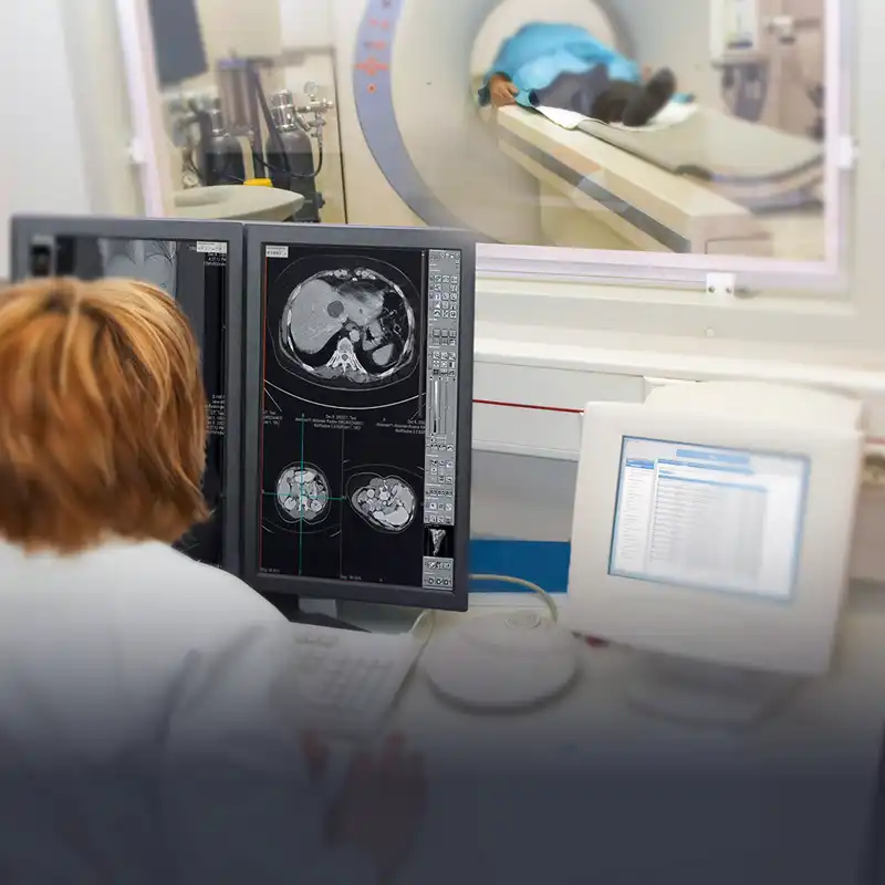 Sistemas digitales de rayos X para clínicas y radiologías