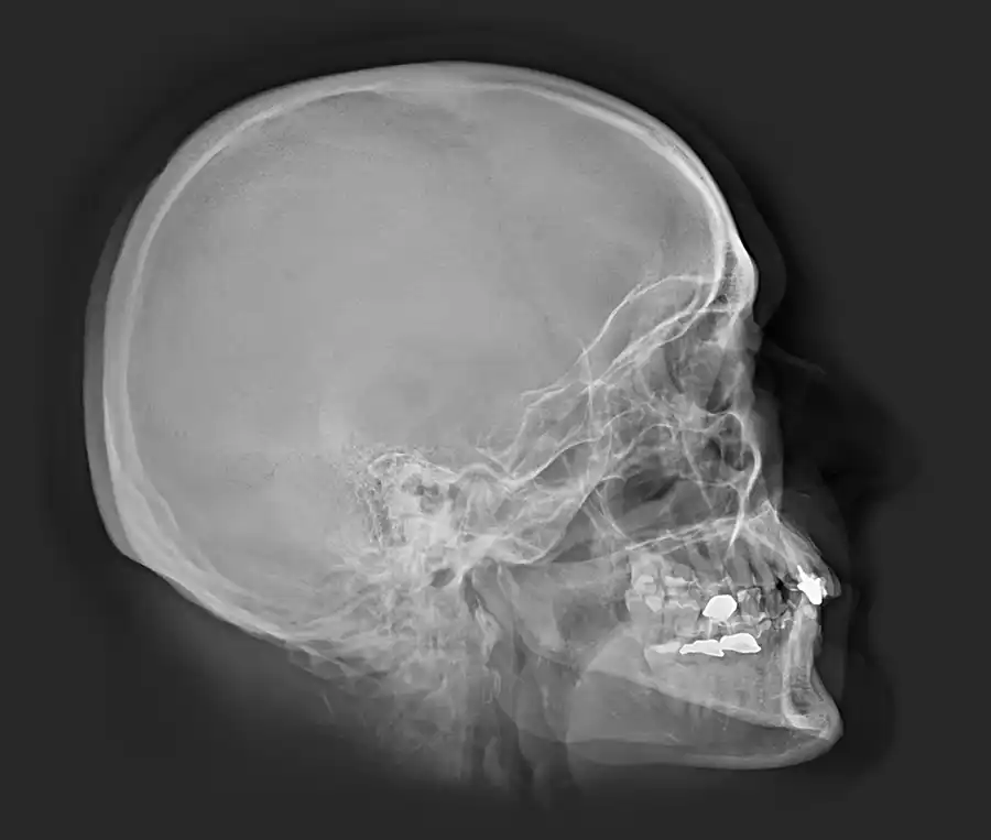 Röntgenaufnahme eines menschlichen Schädels mit dicomPACS geschossen