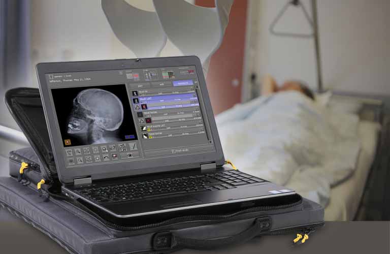 Akquisitionssoftware für Röntgenbilder für tragbare Röntgensysteme sowie stationäre Rüntgenanlagen